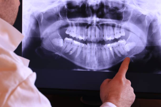 Best Emergency Dentist for Special Needs Patients in Mcadenville, NC