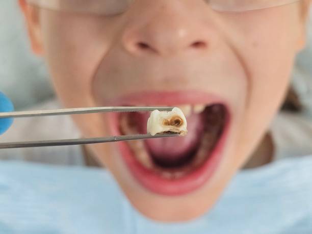 Best Urgent Dental Care for Toothache in Mcadenville, NC